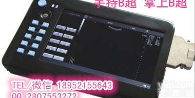 <em>手持式</em>B超 <em>掌上</em>型B超