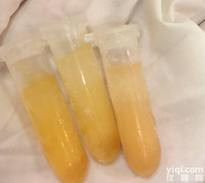 <em>正常人</em><em>血清</em>/混合人<em>血清</em>