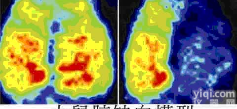 激光多普勒<em>血流</em>灌注<em>成像仪</em>（<em>血流</em>仪）