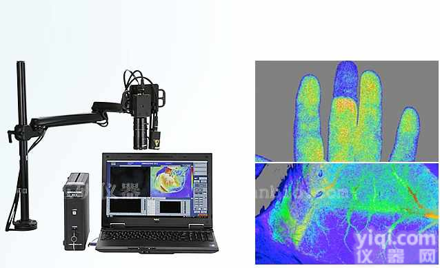 非接触式<em>血流</em><em>成像仪</em>,组织<em>血流</em>仪,<em>血流</em><em>成像仪</em>