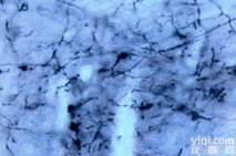 <em>荧光</em>金、<em>荧光</em>金<em>抗体</em>、红色<em>荧光</em>金