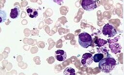 801-D (人<em>巨细胞</em>性<em>肺癌</em>细胞)价格