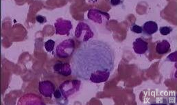 NCI-H524(人非小<em>细胞</em><em>肺癌</em><em>细胞</em>)<em>图片</em>