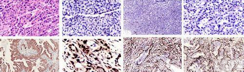 <em>AgNOR的涂片（印片〕染色法核仁染色试剂盒</em>