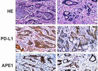 <em>Zugibe 改良硝酸银法特殊细胞染色试剂盒</em>