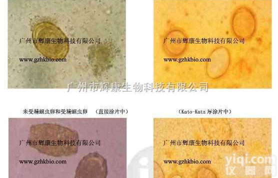 寄生虫卵检测制片盒