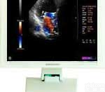 <em>彩超</em><em>显示器</em>