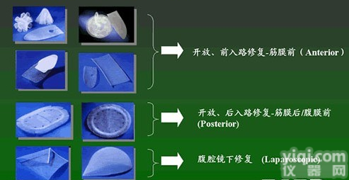 中德/<em>0755</em>-<em>83786766</em>供巴德bard疝修补片网塞