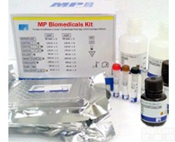 细菌细胞的GX裂解以释放<em>重组</em><em>蛋白质</em>