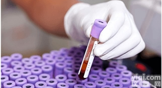 2×<em>热启动PCR预混液</em>