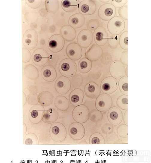 my  寄生虫切片