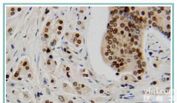 <em>小鼠免疫组化试剂盒代测</em>