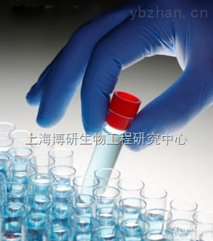 Anti-CCM2<em>抗体</em>,脑<em>海绵状</em>血管<em>畸形</em>蛋白2<em>抗体</em>说明书