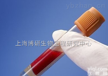 Anti-<em>DNER</em><em>抗体</em>,脑<em>表皮</em>生长因子跨膜蛋白<em>DNER</em><em>抗体</em>