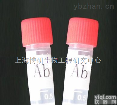 Anti-CRLF1<em>抗体</em>,细胞<em>因子</em><em>受体</em>样<em>因子</em>1<em>抗体</em>产品介绍