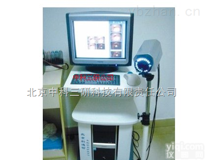 YL09-YX-10  <em>妇科</em><em>阴道</em>数字<em>观察</em>系统 原数码电子<em>阴道</em>镜