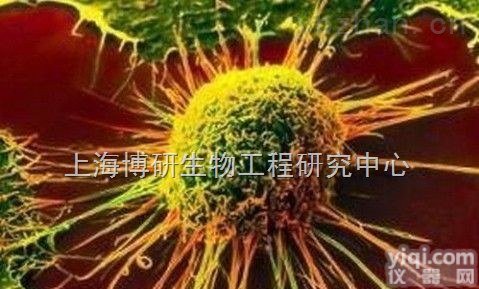<em>小鼠艾氏腹水癌细胞,EAC细胞</em>
