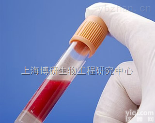 Anti-<em>H5N1 Matrix Protein 2抗体,A型禽流感病毒H5N1-M2蛋白抗体</em>供应商