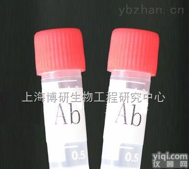 Anti-IL-18/IGIF抗体,<em>白细胞</em><em>介素</em>-18/<em>干扰素</em>γ诱导因子抗体实实在在
