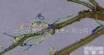 HAD-XYA  根系分析系统/<em>根系分析仪</em>