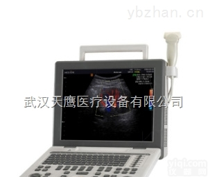 SONOACE R3 <em>三星</em>彩色<em>超声</em><em>诊断</em>系统