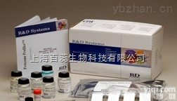 碳酸盐<em>缓冲液</em>大量<em>现货供应</em>,一对一提供咨询