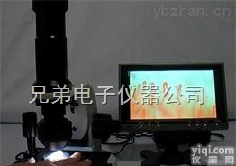 XD88  青岛<em>高清晰</em><em>微循环</em><em>检测仪</em>