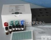 <em>Anti-GOLPH2抗体,高尔基体膜蛋白GP73抗体</em>推荐产品