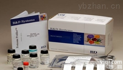 <em>免疫</em><em>球蛋白</em>IgG测定试剂盒（<em>免疫</em>比浊法），<em>现货供应</em>