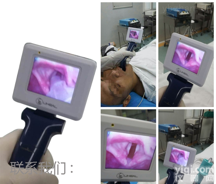 HT-AD  工厂直供气管插管麻醉视频<em>喉镜</em> 麻醉<em>可视</em><em>喉镜</em> <em>可视</em><em>喉镜</em>解决方案