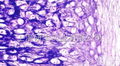 <em>小鼠</em>前胃癌低转移细胞（绿色荧光蛋白<em>标记</em>）；MFC-B5-GFP<em>售后服务</em>