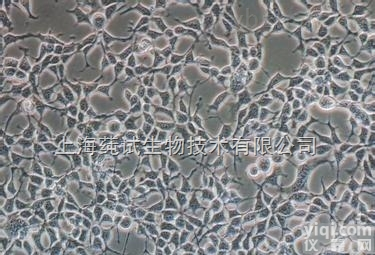 人肾透明细胞<em>癌细胞</em>；LoMet-ccRCC<em>说明书</em>