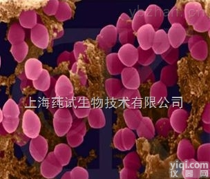 人<em>肾上腺</em><em>腺瘤</em>细胞；NCI-H205上海<em>直销</em>