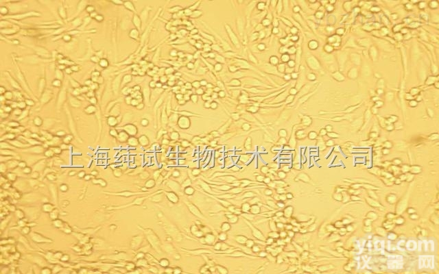 <em>TNFa转染耐VP16绒癌细胞；JEG-3-VP16-TNFa说明书</em>