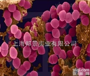 人<em>膀胱</em>移行细胞<em>癌细胞</em>；T-24运输<em>保存</em>