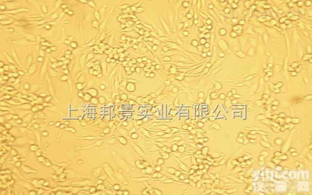 人大细胞肺<em>癌细胞</em>；NCI-H661运输<em>保存</em>