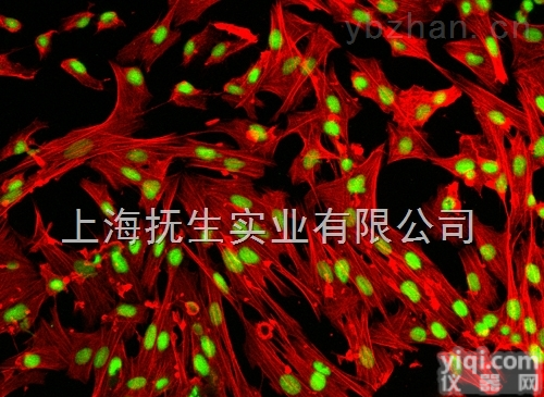 小鼠肾<em>动脉</em><em>内皮</em>细胞完全<em>培养基</em>培养